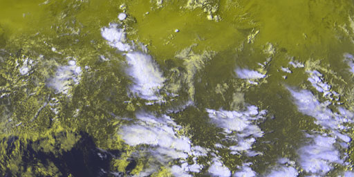 European HRV (E-View) - 0 Degree